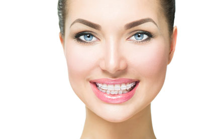 Wear Clear Braces For A Convenient Way To Straighten Your Teeth