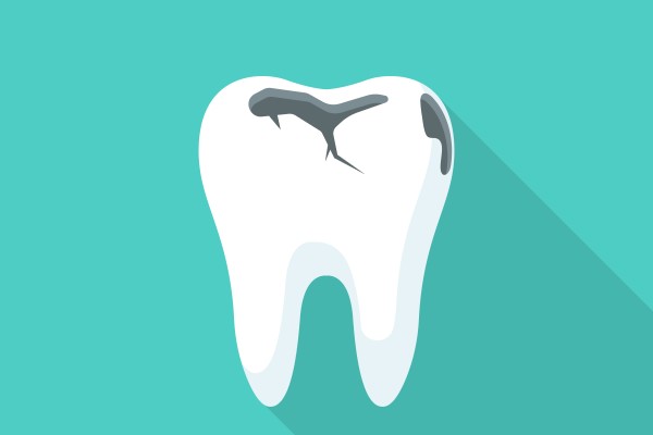Questions To Ask Your Dentist About A Cracked Tooth