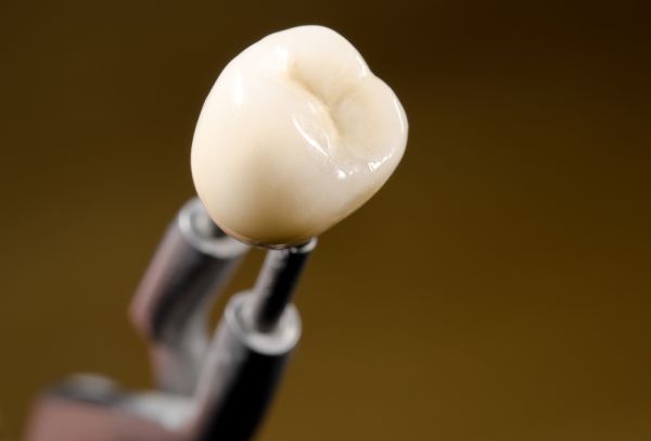 dental implant crown Sunnyvale, TX