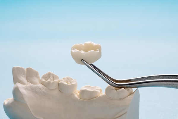Foods To Avoid With Dental Crowns