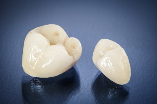 Give Your Teeth An Upgrade With Dental Crowns
