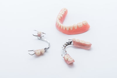 Implant Supported Dentures: Value For Your Money