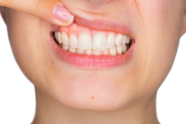 Who Can Help Treat Gum Disease?