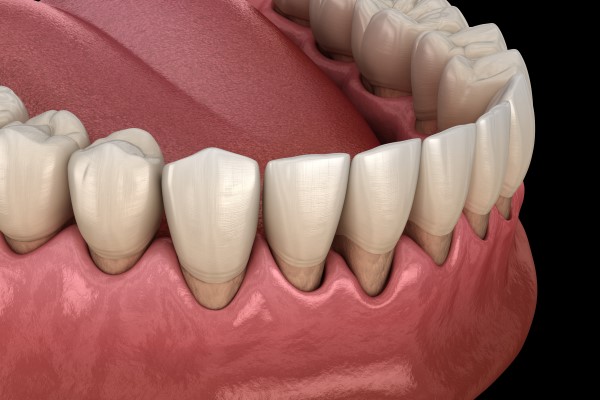 Signs And Symptoms Of Gum Disease