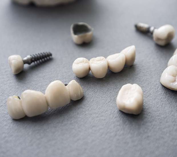 Sunnyvale The Difference Between Dental Implants and Mini Dental Implants
