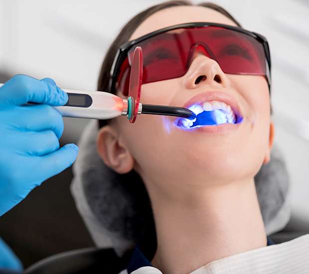 Sunnyvale Professional Teeth Whitening