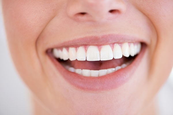 Reasons To Get Your Teeth Whitening Done By A Professional